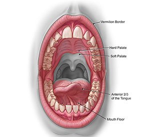 Oral Oncology Oral Oncology in Hyderabad
