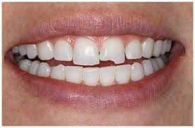 Cosmetic Dentistry