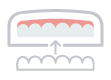 Invisible Aligners in Hyderabad