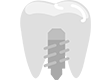 Dental Implants in Hyderabad