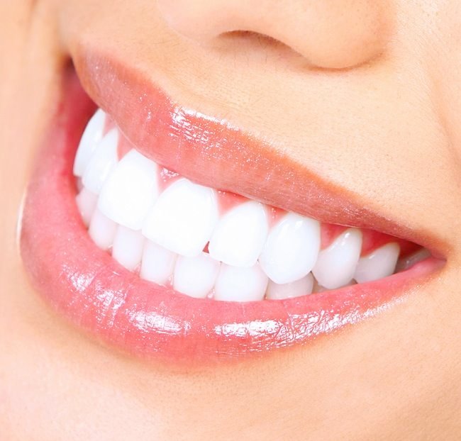 You are Smiling, Do Your Teeth Too?