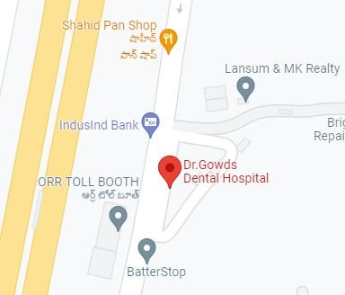 dental hospital in puppalaguda, dental clinic in gachibowli